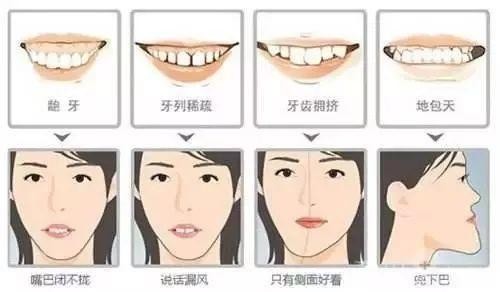常见牙齿畸形六种情况，详细解析牙齿矫正全过程