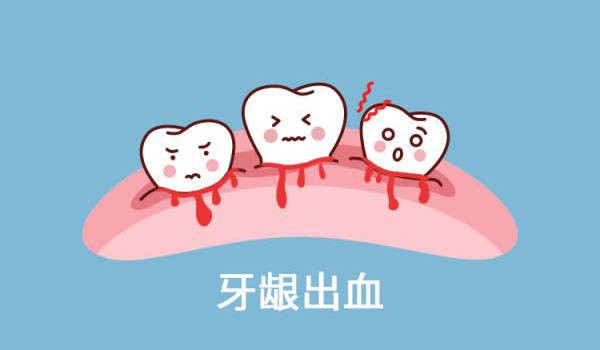 牙龈出血怎么办？试试这几个偏方让你得牙齿立马止血