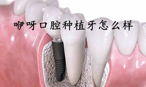 武汉咿呀口腔正规吗？这家医院种植牙技术靠谱吗？