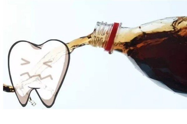 汽水真的会腐蚀牙齿？你别不信，过量喝汽水小心有一口烂牙