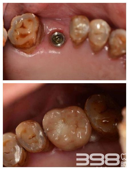 北京维嘉口腔门诊部是正规的吗？种植牙技术可靠吗？