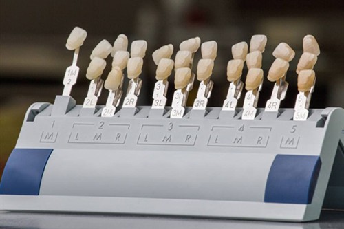 牙齿瓷贴面需要多少钱？为什么医生不建议做牙齿贴面？