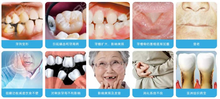 牙齿缺失的危害