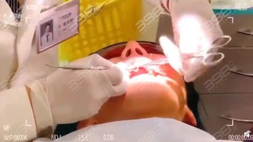 求北京看牙十大医院中北京私立口腔医院推荐，做舌侧矫正