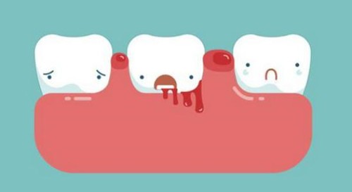 5类人不能做牙齿矫正？看中信惠州医院口腔科怎么说