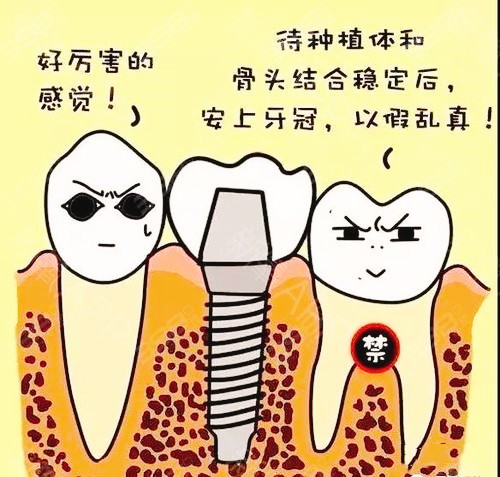 种植牙的弊端是什么？