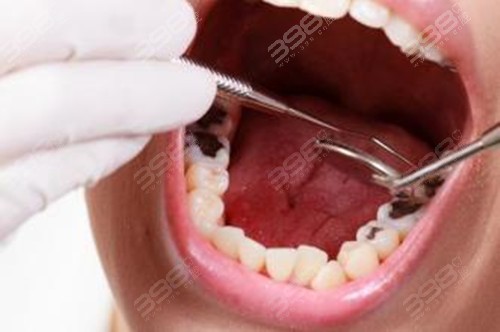 标准的牙齿咬合图片是什么样？