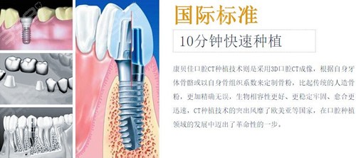北京种植牙医生排名中邱麟的技术和口碑如何？