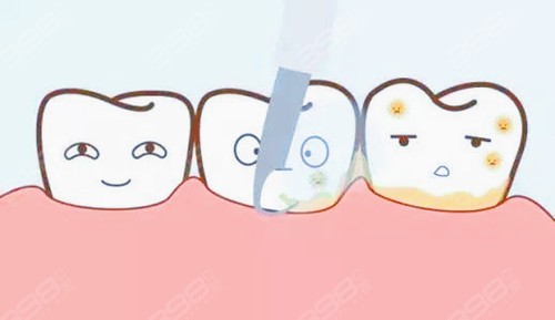 洗牙能把黄牙洗白吗？为什么医生不推荐洗牙？有什么弊端