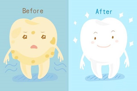 厦门冷光美白牙齿多少钱 一次就可以白？效果能维持多久？