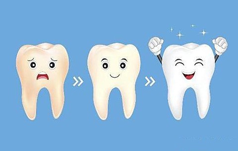 牙齿美白方式哪种好？价格多少？看几种美白方式的优缺点