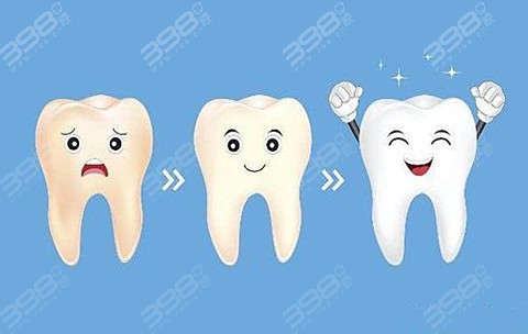 牙齿美白方式哪种好？