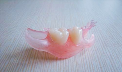 镶牙的材料有哪些？哪个材质更好？镶牙材料价格表有吗？