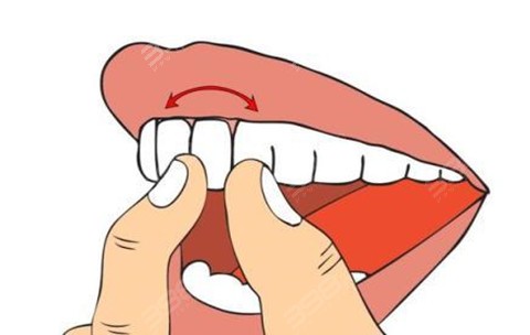 门牙松动了怎么处理？松牙固定术是什么？靠谱吗？