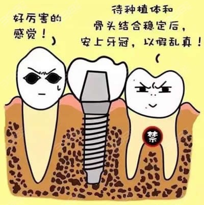 种植牙的危害