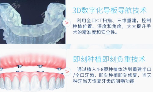 北京哪里种牙便宜又好？