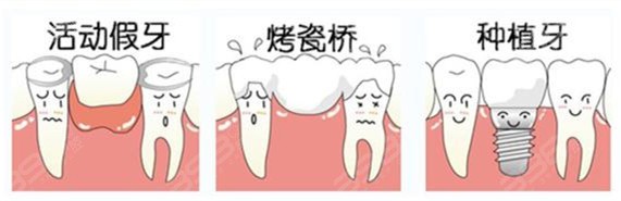六十岁老人种牙好还是镶牙好？告诉你种植牙与活动义齿的区别