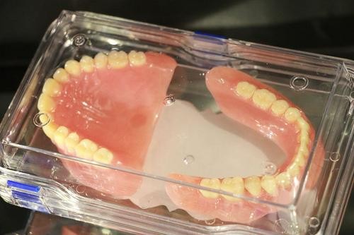 伤害最小的是活动假牙是哪种？无挂钩镶牙是怎么回事？多少钱？