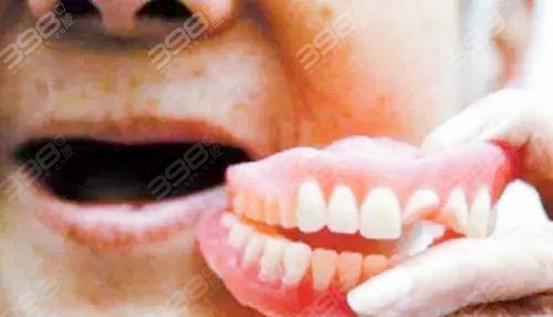 伤害小的是活动假牙是哪种？无挂钩镶牙是怎么回事？多少钱？