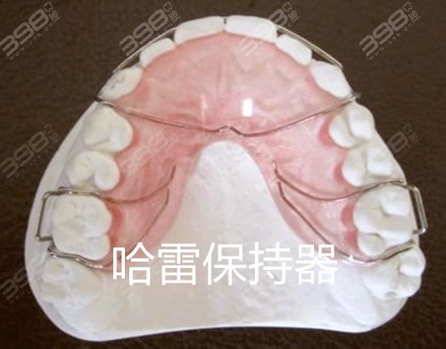 牙齿矫正保持器-哈雷保持器