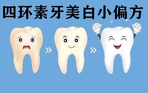 有四环素牙的美白偏方吗？打死牙医都不会告诉你的牙齿美白方法