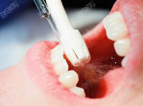北京洗牙好医院排名评选：多少钱？可以用医保吗？