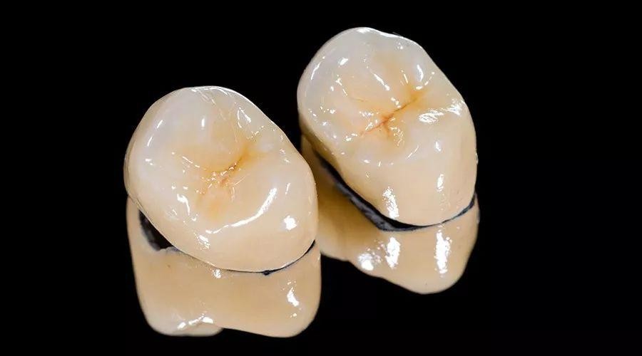 烤瓷牙能用十几年，但里面的牙齿却烂掉了？