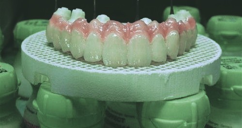 半口牙缺失选韩系种植牙划算，价格与使用寿命均可！