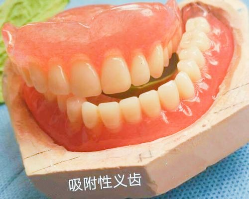 北京全口义齿价格表：bps吸附性义齿价格贵吗？能用多少年？