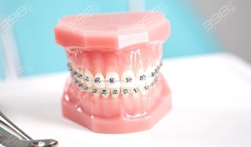 缺牙一定要做种植牙吗？NO！缺失一颗牙可以通过牙齿矫正来改善