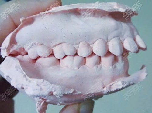 美容冠可以矫正龅牙吗？门牙突出矫正方法是什么？