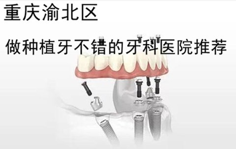 重庆渝北区做瑞典诺贝尔种植牙多少钱？重庆有没有好的牙科医院推荐