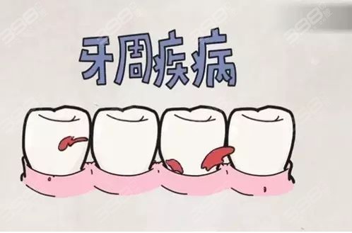 牙周疾病危害