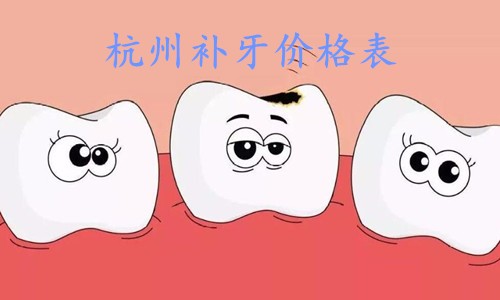 杭州补牙多少钱一颗？全新杭州口腔医院补牙价格表上线啦