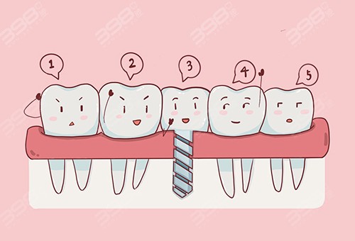 北京哪家医院种牙技术好？韩国登腾种植牙怎么样？价格如何？