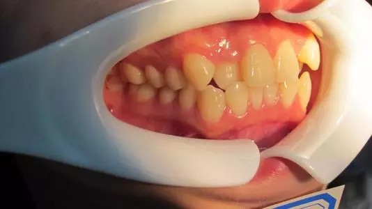 十堰口腔医院排名中，哪家牙齿矫正技术好？求价目表分享