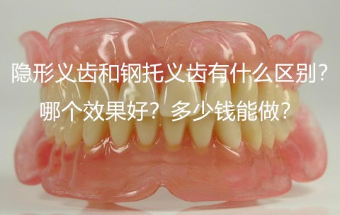 隐形义齿和钢托义齿有什么区别？哪个效果好？多少钱能做？