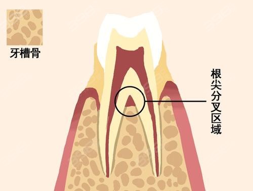 槽牙位置图图片