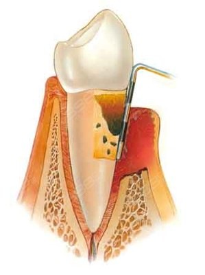 牙体牙髓示意图