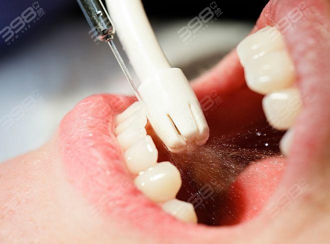 洗牙会得传染病吗？