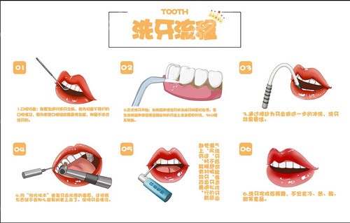 洗牙流程
