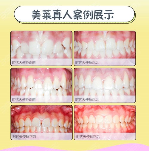 2021天津口腔医院收费价目表更新,这几家牙科价格快收藏!