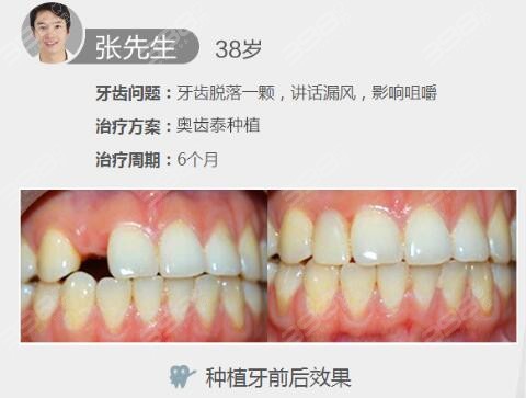 西安海涛口腔医院收费价目表公布,瞧瞧正规牙科看牙贵不?