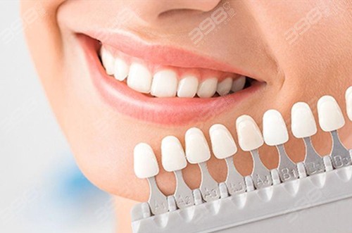 惠州牙齿美白多少钱？