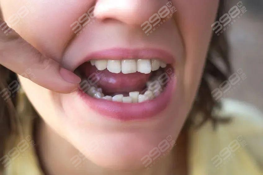 牙齿矫正和种牙可以同时进行吗