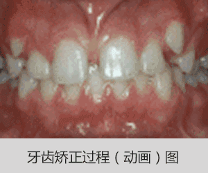 2021重庆牙科收费价目表