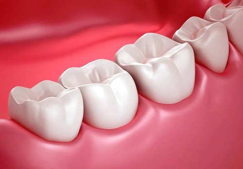 种植牙对年龄有限制吗？60多岁适合种植牙吗？