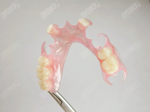 牙齿缺失修复方法-活动义齿