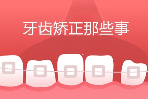 更新2021广州牙套价目表 看广州牙齿矫正多少钱？