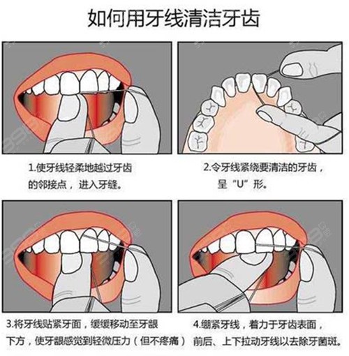 如何使用牙线